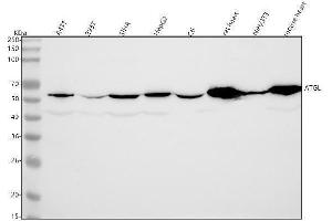 Western blot analysis of ATGL/PNPLA2 using anti-ATGL/PNPLA2 antibody (ABIN7604063).