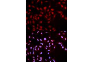 Immunofluorescence analysis of U2OS cell using Phospho-MET-Y1349 antibody. (c-MET Antikörper  (pTyr1349))