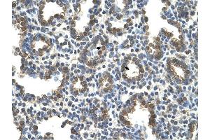 SLC37A3 antibody was used for immunohistochemistry at a concentration of 4-8 ug/ml to stain Alveolar cells (arrows) in Human Lung. (SLC37A3 Antikörper)
