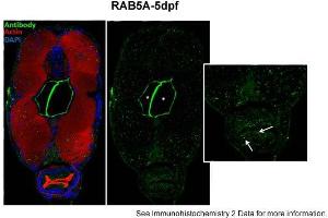 Sample type: zebra gut epithelial cellsGreen: primaryRed: actinBlue: DAPIPrimary dilution: 1:5000Secondary Dilution: 1:300Image Submitted by: Michel BagnatDuke University Medical Center . (RAB5 Antikörper  (Middle Region))