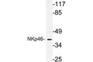 Western blot (WB) analysis of NKp46 antibody in extracts from A549 cells. (NCR1 Antikörper)
