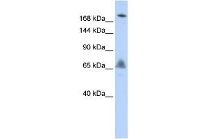 WB Suggested Anti-VPS8 Antibody Titration:  0. (VPS8 Antikörper  (N-Term))