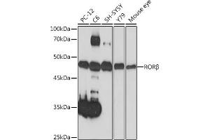 Western blot analysis of extracts of various cell lines, using RORβ Rabbit mAb (ABIN7269855) at 1:1000 dilution. (RORB Antikörper)