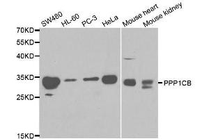 Western blot analysis of extracts of various cell lines, using PPP1CB antibody. (PPP1CB Antikörper  (AA 1-327))