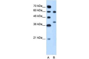 Arginase 1 antibody used at 5 ug/ml to detect target protein. (Liver Arginase Antikörper  (Arg1, N-Term))