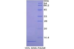 SDS-PAGE analysis of Mouse ARPC4 Protein. (ARPC4 Protein)