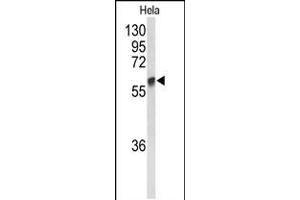 Western blot analysis of GALNT2 Antibody in Hela cell line lysates (35ug/lane)
