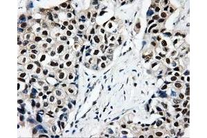Immunohistochemical staining of paraffin-embedded Kidney tissue using anti-CISD1mouse monoclonal antibody. (CISD1 Antikörper)