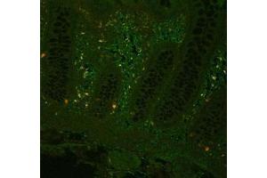 Image no. 3 for anti-Tumor Necrosis Factor alpha (TNF alpha) antibody (ABIN799618) (TNF alpha Antikörper)