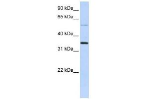 ANKRD9 antibody used at 1 ug/ml to detect target protein. (ANKRD9 Antikörper  (Middle Region))