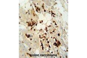 Immunohistochemistry (IHC) image for anti-DDB1 and CUL4 Associated Factor 4-Like 2 (DCAF4L2) antibody (ABIN2995734) (DCAF4L2 Antikörper)