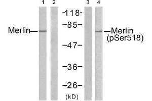 Western blot analysis of extracts from H (Merlin Antikörper)