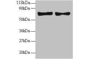 Western blot All lanes: CCL5 antibody at 2 μg/mL Lane 1: EC109 whole cell lysate Lane 2: 293T whole cell lysate Secondary Goat polyclonal to rabbit IgG at 1/15000 dilution Predicted band size: 10 kDa Observed band size: 70 kDa (CCL5 Antikörper  (AA 24-91))