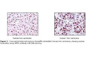 Image no. 1 for anti-Nucleophosmin (Nucleolar phosphoprotein B23, Numatrin) (NPM1) antibody (ABIN207591) (NPM1 Antikörper)