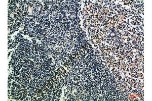 Immunohistochemical analysis of paraffin-embedded Human-tonsil, antibody was diluted at 1:100