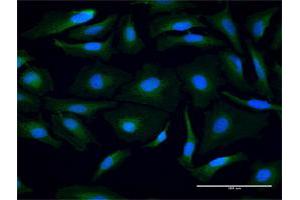 Immunofluorescence of purified MaxPab antibody to PSMB3 on HeLa cell. (PSMB3 Antikörper  (AA 1-205))