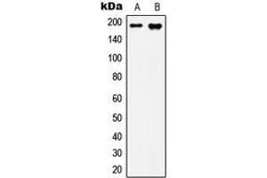 Western blot analysis of IQGAP3 expression in MCF7 (A), HepG2 (B) whole cell lysates. (IQGAP3 Antikörper  (N-Term))