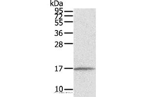 Western blot analysis of Human normal liver tissue, using EVA1A Polyclonal Antibody at dilution of 1:550 (TMEM166 Antikörper)