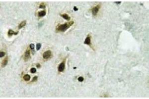 Immunohistochemistry  (IHC) analyzes of TFIIIC102 antibody in paraffin-embedded human brain tissue. (GTF3C3 Antikörper)