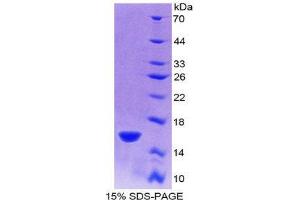 SDS-PAGE (SDS) image for R-Spondin 1 (RSPO1) (AA 21-135) protein (His tag) (ABIN1878271)
