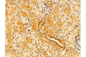 ABIN6261329 and ABIN6273042 at 1/100 staining Rat kidney tissue by IHC-P. (DNAJB14 Antikörper  (C-Term))