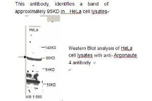 Image no. 1 for anti-Eukaryotic Translation Initiation Factor 2C, 4 (EIF2C4) antibody (ABIN790840) (AGO4 Antikörper)