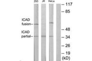 Western blot analysis of extracts from Jurkat/293/HeLa cells, using DFFA Antibody. (DFFA Antikörper  (AA 151-200))