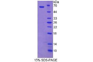 Image no. 1 for ATP-Binding Cassette, Sub-Family D (Ald), Member 1 (ABCD1) (AA 102-386) protein (ABIN6239359)