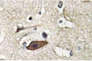 Immunohistochemistry (IHC) analyzes of Tsg 101 antibody in paraffin-embedded human brain tissue. (TSG101 Antikörper)