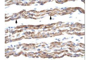 Image no. 1 for anti-Polyglutamine Binding Protein 1 (PQBP1) (AA 58-107) antibody (ABIN202137) (PQBP1 Antikörper  (AA 58-107))