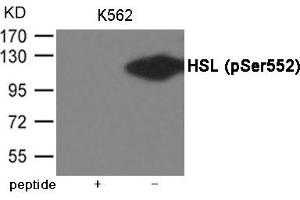 Western blot analysis of extracts from K562 cells using HSL (Phospho-Ser552) Antibody. (LIPE Antikörper  (pSer552))