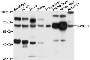 Western blot analysis of extracts of various cell lines, using ACVRL1 antibody (ABIN5996082) at 1/1000 dilution. (ACVRL1 Antikörper)