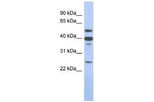 MMP13 antibody used at 1 ug/ml to detect target protein. (MMP13 Antikörper)