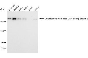 Western blotting analysis using Chromodomain helicase DNA binding protein 3 antibody (ABIN7798069). (Rekombinanter CHD3 Antikörper)