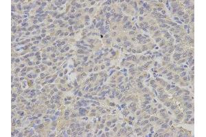 Immunohistochemistry (IHC) image for anti-Proteasome (Prosome, Macropain) 26S Subunit, ATPase, 2 (PSMC2) antibody (ABIN1874379) (PSMC2 Antikörper)