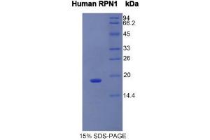 SDS-PAGE (SDS) image for Ribophorin 1 (RPN1) (AA 180-307) protein (His tag) (ABIN1981107)