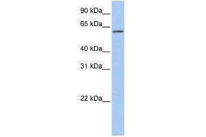 Western Blotting (WB) image for anti-Solute Carrier Family 22 (Organic Cation Transporter), Member 14 (SLC22A14) (N-Term) antibody (ABIN2781615)
