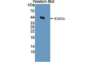 Detection of Recombinant IL11Ra, Rat using Polyclonal Antibody to Interleukin 11 Receptor Alpha (IL11Ra) (IL11RA Antikörper  (AA 24-371))