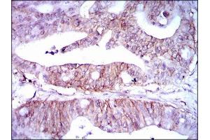 Immunohistochemistry (IHC) image for anti-Lipoprotein (Lp(a)) (AA 4330-4521) antibody (ABIN1845714) (Lp(a) Antikörper  (AA 4330-4521))