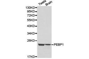 Western Blotting (WB) image for anti-Phosphatidylethanolamine Binding Protein 1 (PEBP1) antibody (ABIN1874092) (PEBP1 Antikörper)