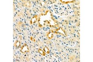Immunohistochemistry of paraffin embedded rat kidney using Dmac2l (ABIN7073751) at dilution of 1: 650 (400x lens) (Distal Membrane Arm Assembly Complex 2 L Homeolog (DMAC2.L) Antikörper)