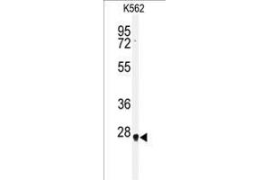 Western blot analysis of HMGB2 antibody (Center) in K562 cell line lysates (35 µg/lane). (HMGB2 Antikörper  (Middle Region))
