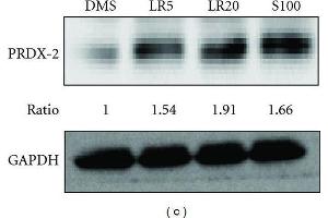 Western Blotting (WB) image for anti-Glyceraldehyde-3-Phosphate Dehydrogenase (GAPDH) antibody (ABIN2857072)