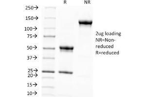 SDS-PAGE Analysis Purified Melanoma Monoclonal Antibody (KBA. (Melanoma Associated Antigen (KBA.62) Antikörper)