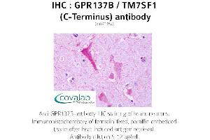 Image no. 2 for anti-G Protein-Coupled Receptor 137B (GPR137B) (C-Term) antibody (ABIN1734939) (GPR137B Antikörper  (C-Term))