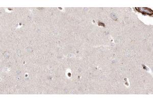 Immunohistochemistry (IHC) image for anti-Piezo-Type Mechanosensitive Ion Channel Component 1 (PIEZO1) (Internal Region) antibody (ABIN6264200)