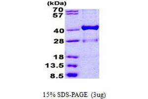 SDS-PAGE (SDS) image for Hydroxysteroid (17-Beta) Dehydrogenase 1 (HSD17B1) (AA 1-328) protein (His tag) (ABIN5852977) (HSD17B1 Protein (AA 1-328) (His tag))