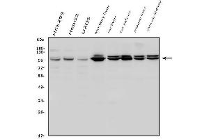 Western blot analysis of Aconitase 1/ACO1 using anti-Aconitase 1/ACO1 antibody (ABIN7598988).