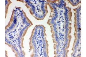 IHC testing of FFPE mouse intestine with ITPR3 antibody. (ITPR3 Antikörper)