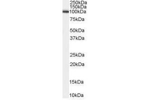 Image no. 1 for anti-ADAM Metallopeptidase Domain 17 (ADAM17) (C-Term) antibody (ABIN374190) (ADAM17 Antikörper  (C-Term))
